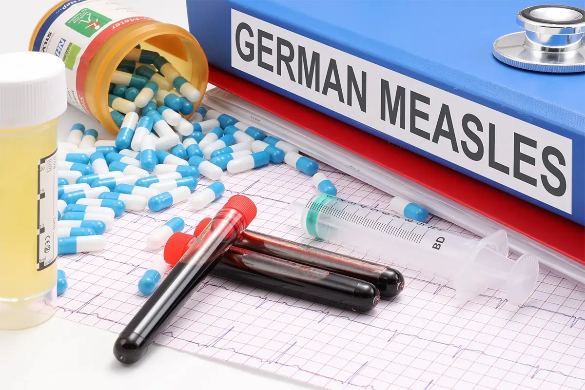 german_measles